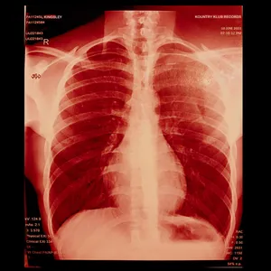 KING KONG Single album cover